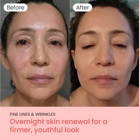 Lakerain® Turmeric & Collagen Night Wrapping Mask Duo